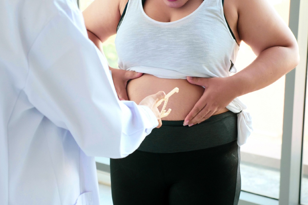 Cirurgia Bariátrica